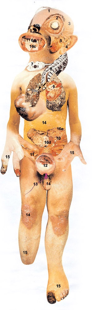 吸菸的BODY_img